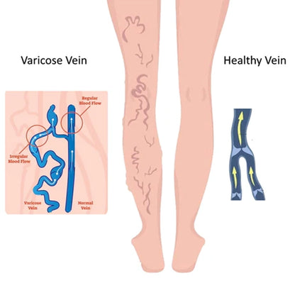 🧦 Stay Warm Naturally with Self-Heating Therapy Socks